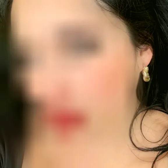Skye, 37